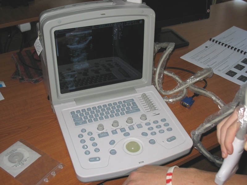 [Digitálny ultrazvukový diagnostický prístroj WED-180.]